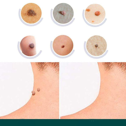 Hydrocolloid Skin Care Patches for Targeted Spot Coverage 120 Pack