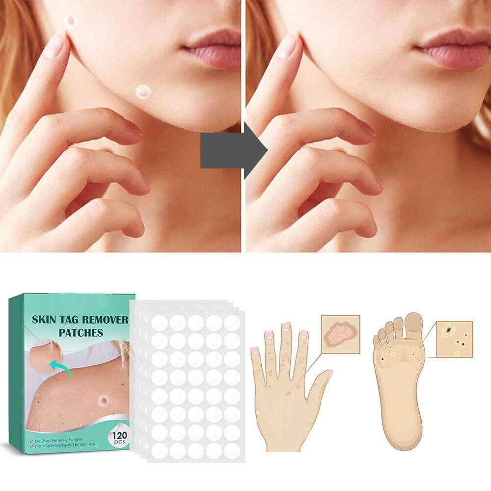 Hydrocolloid Skin Care Patches for Targeted Spot Coverage 120 Pack