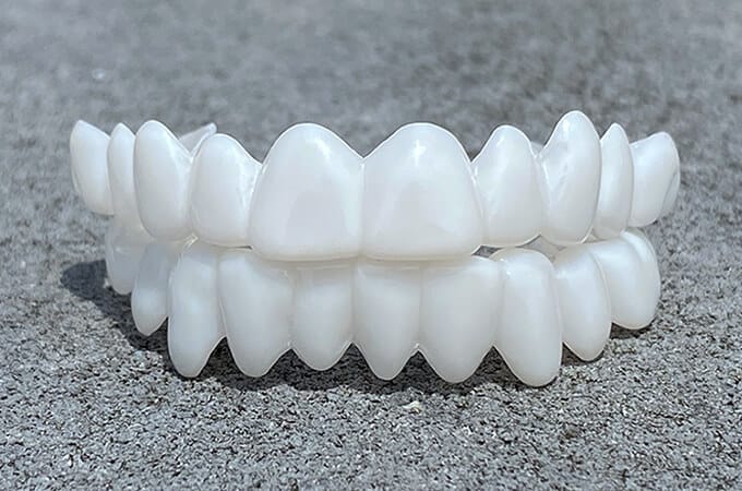 Removable Cosmetic Dental Veneer for Natural Looking Smile